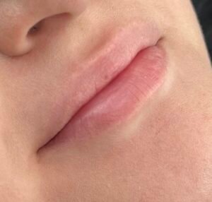 before lip blush