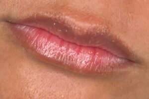 dark lips before neutralization
