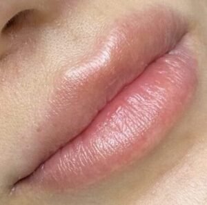 lips before